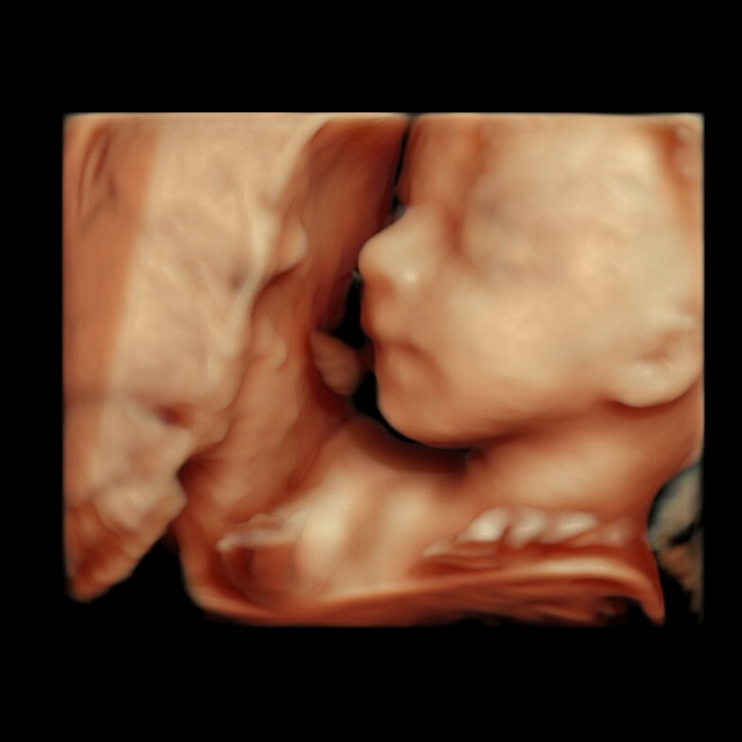 Photo shared by Brianne for their Babylist baby registry.
