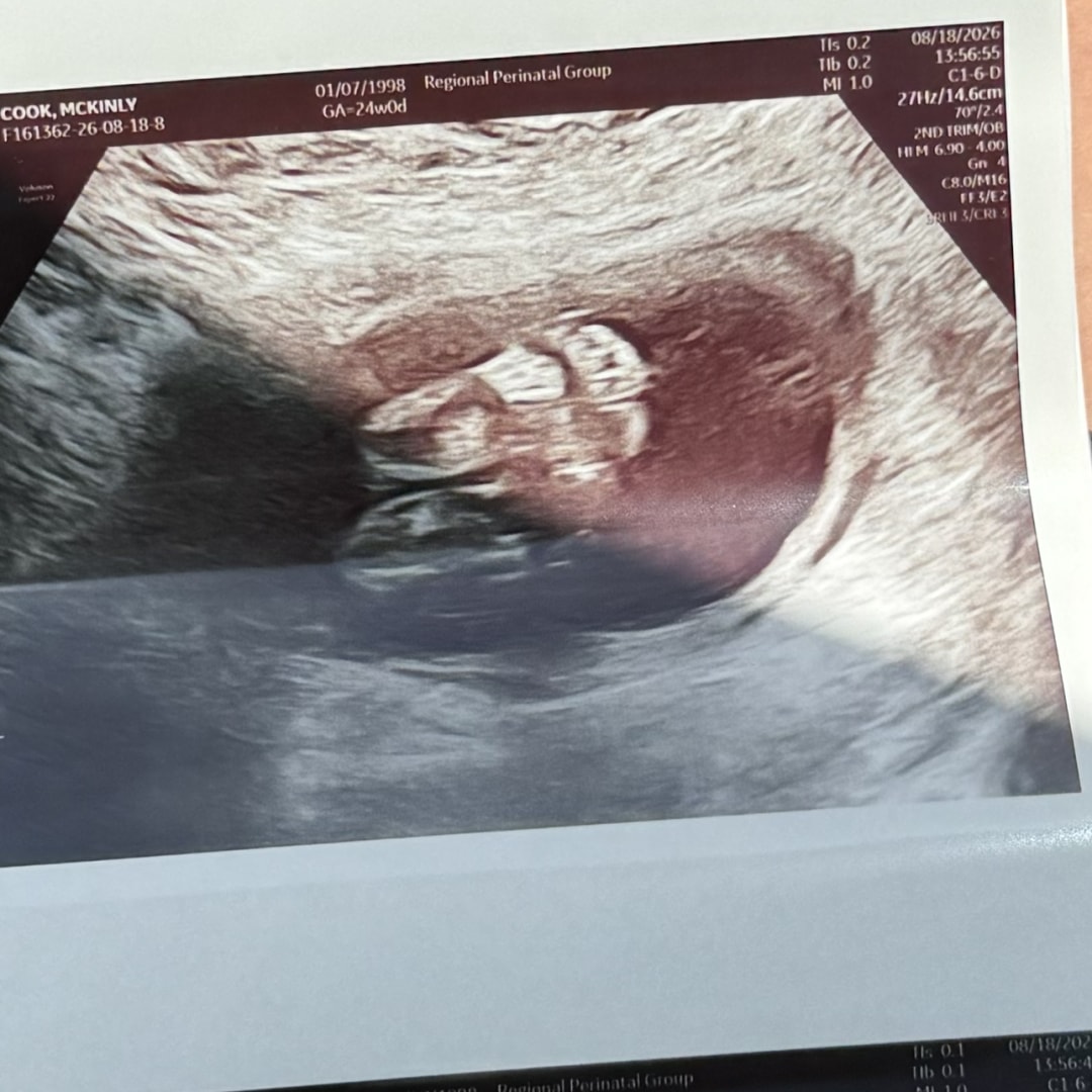 Photo shared by Mckinly for their Babylist baby registry.