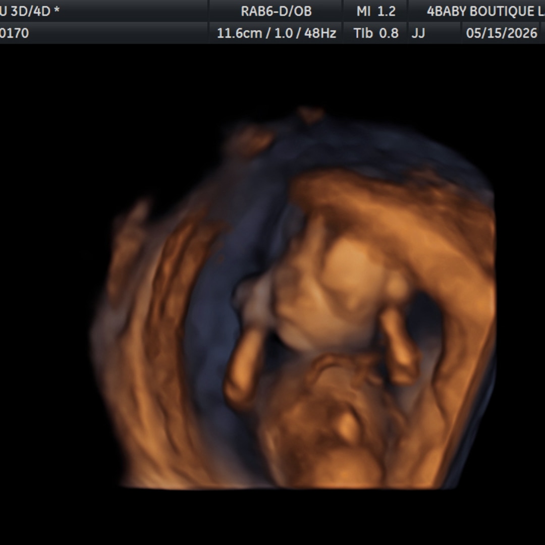 Photo shared by Claudia for their Babylist baby registry.