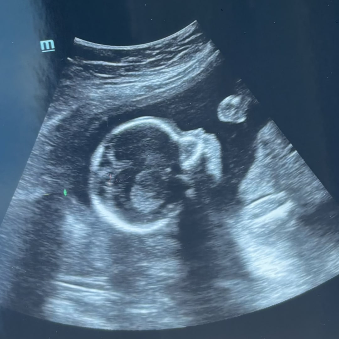 Photo shared by Qiyanna for their Babylist baby registry.