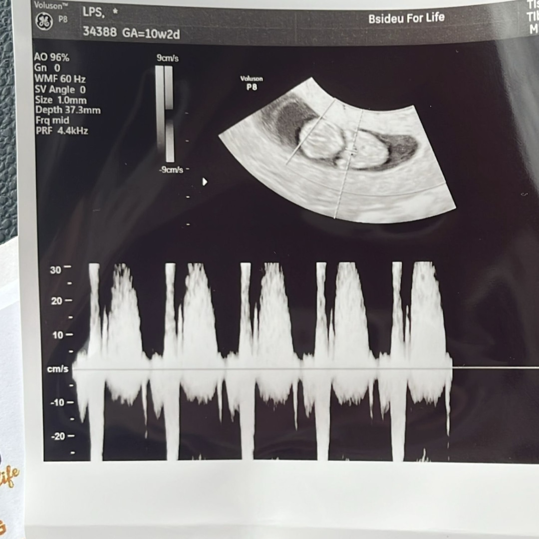 Photo shared by Lenny for their Babylist baby registry.