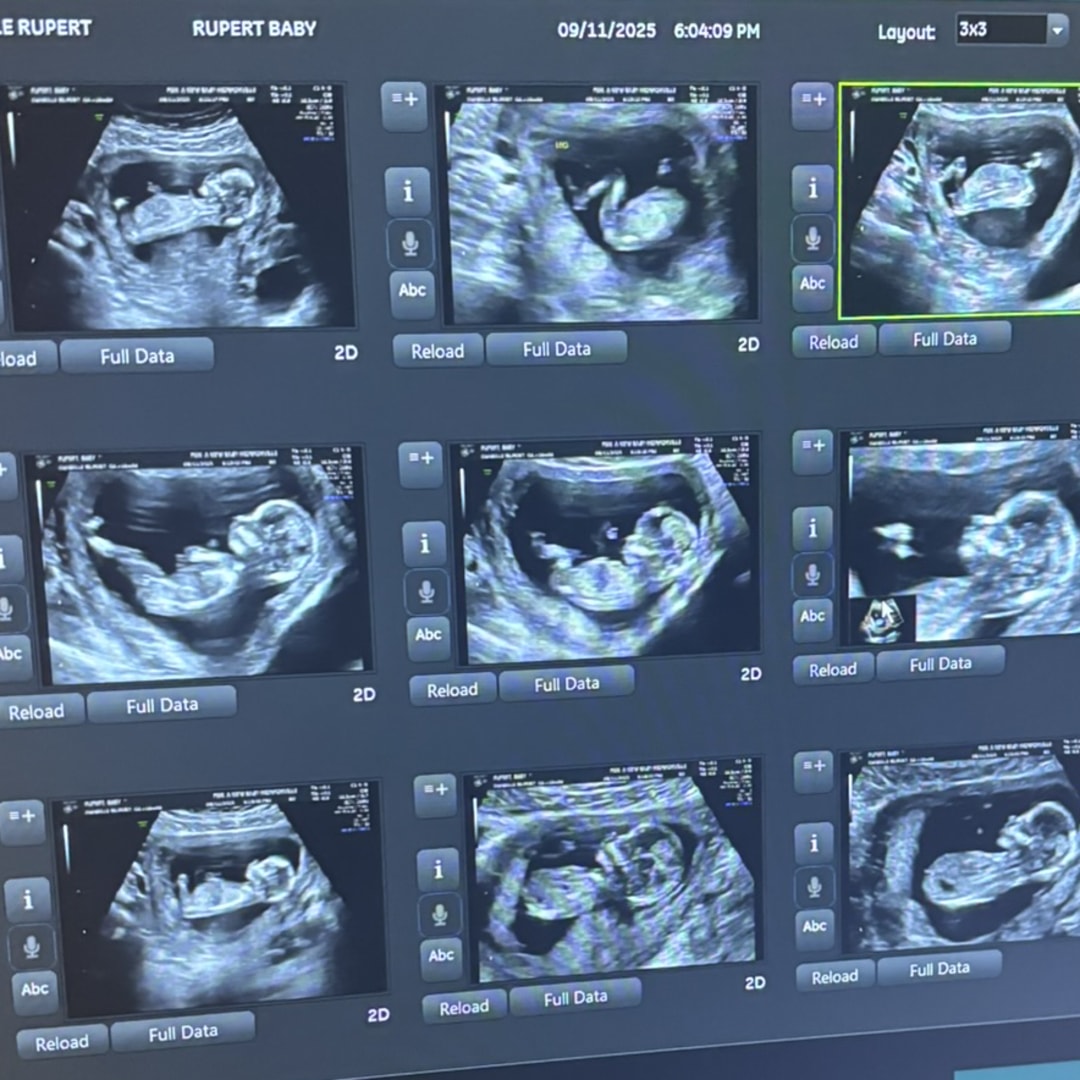 Photo shared by Danielle for their Babylist baby registry.