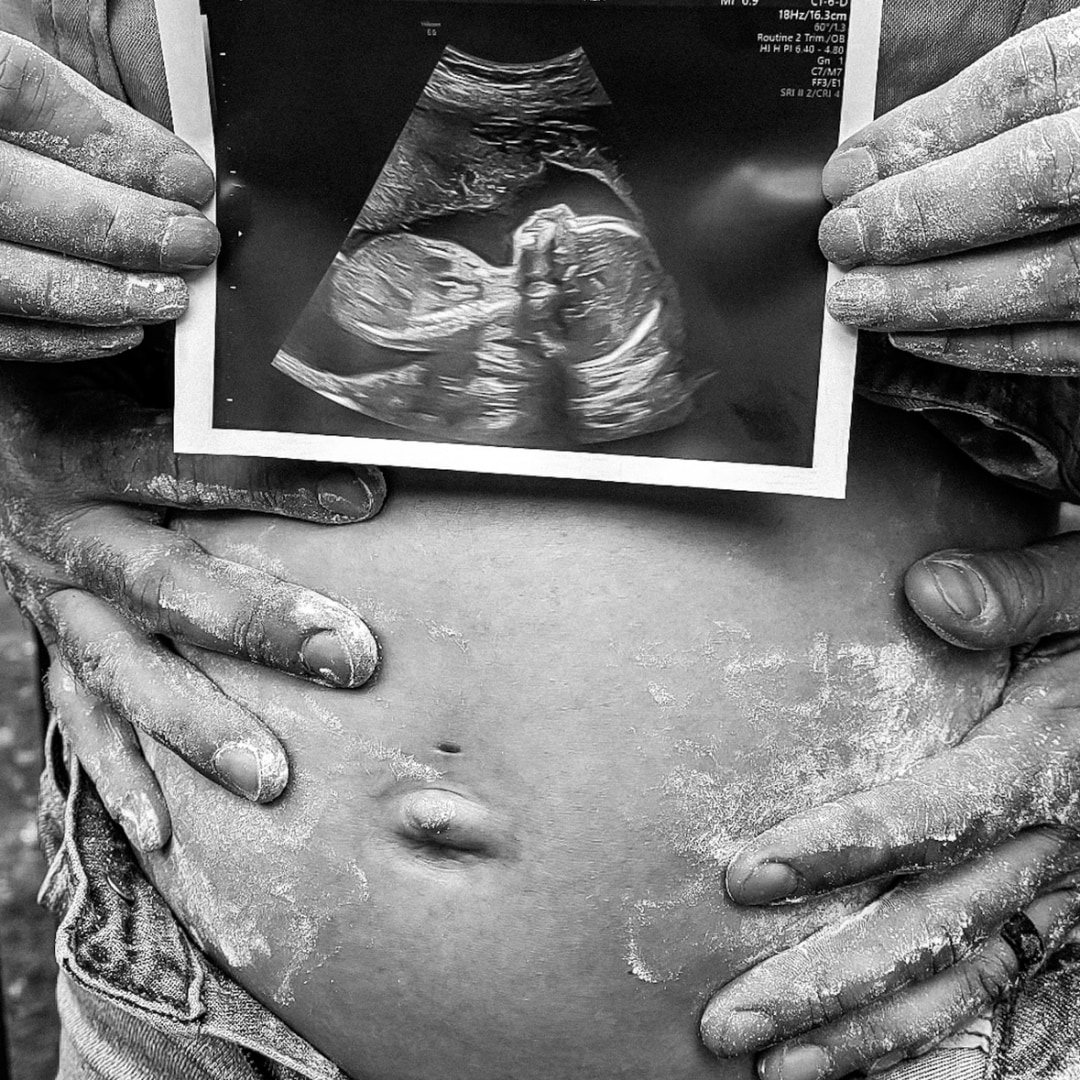 Photo shared by Sydney for their Babylist baby registry.