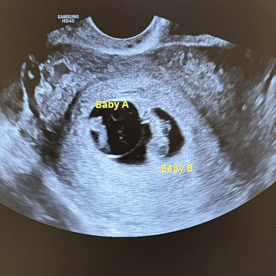 Photo shared by Ashley for their Babylist baby registry.