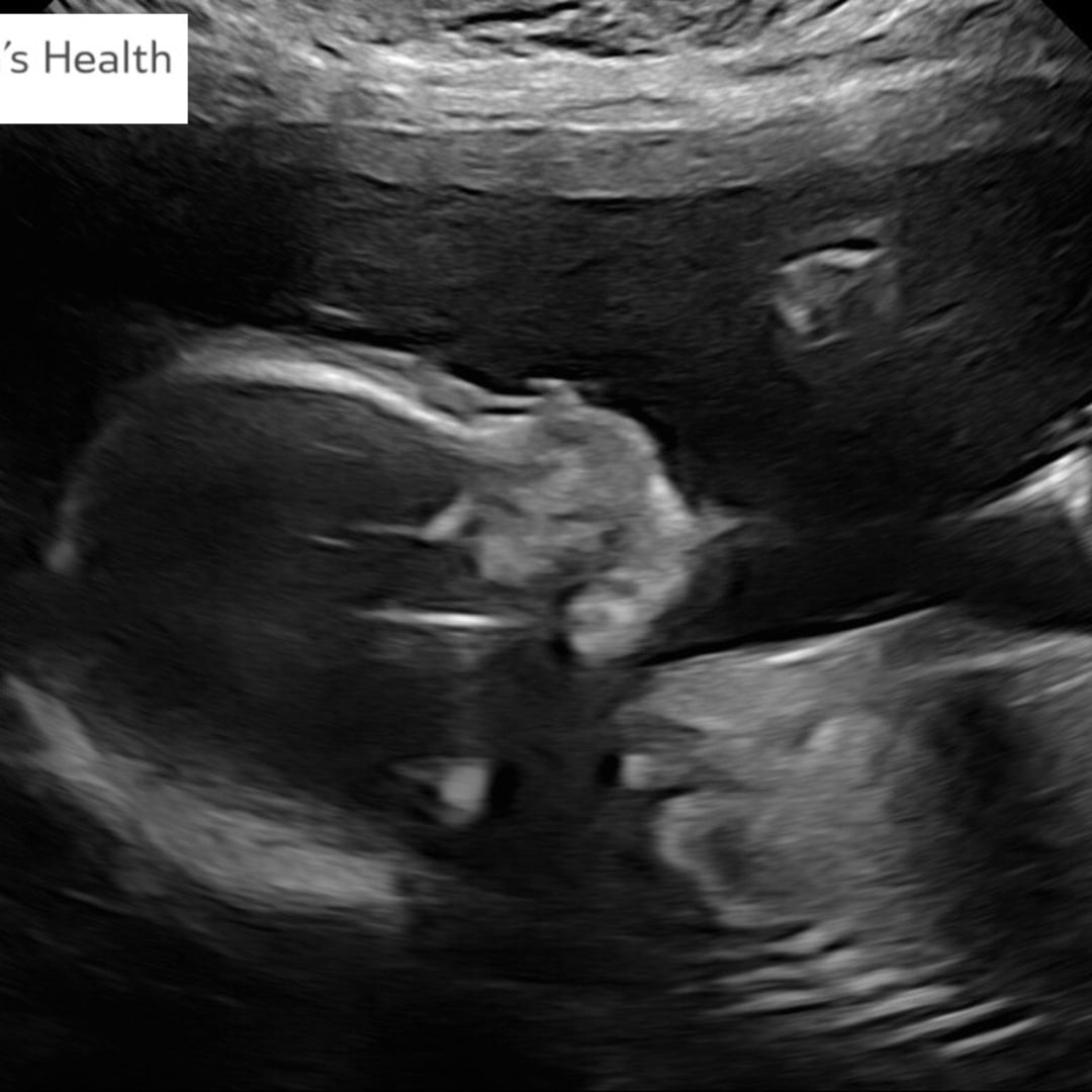 Photo shared by Elisabeth for their Babylist baby registry.