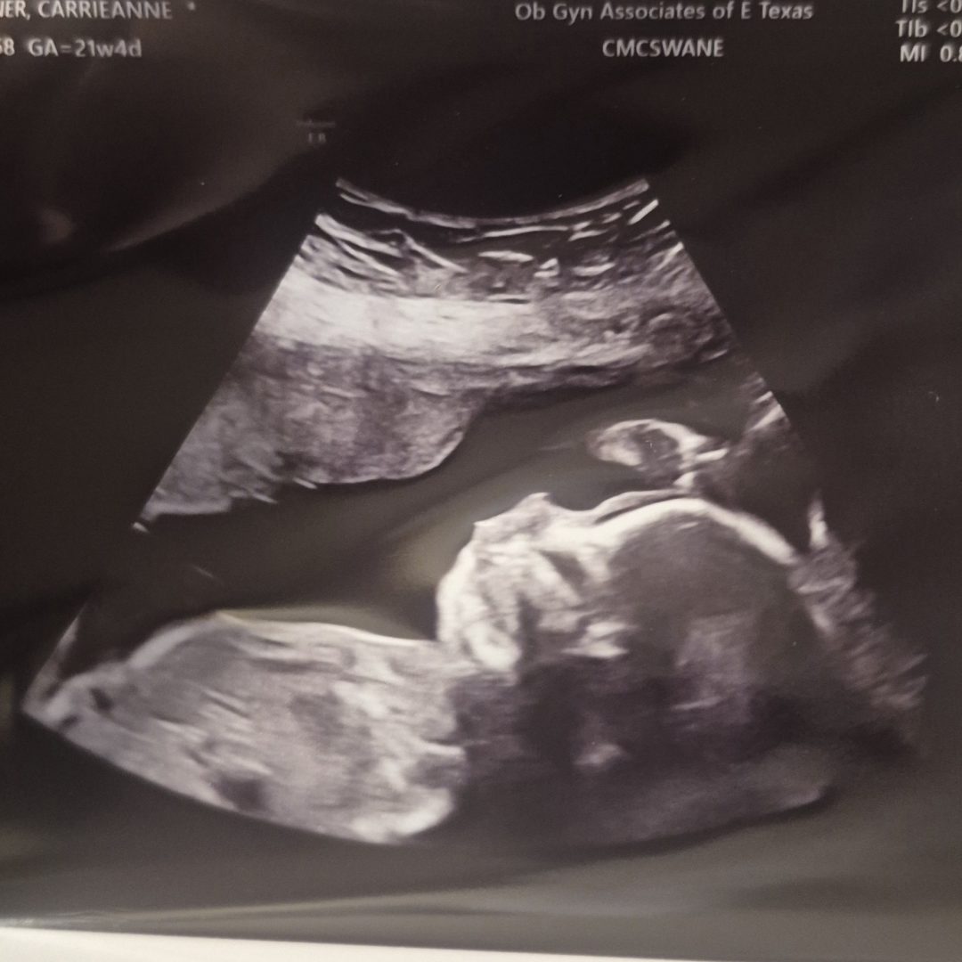 Photo shared by Carrieanne for their Babylist baby registry.