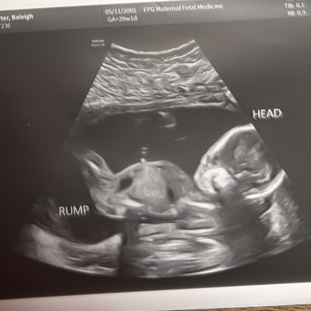 Photo shared by Baleigh for their Babylist baby registry.