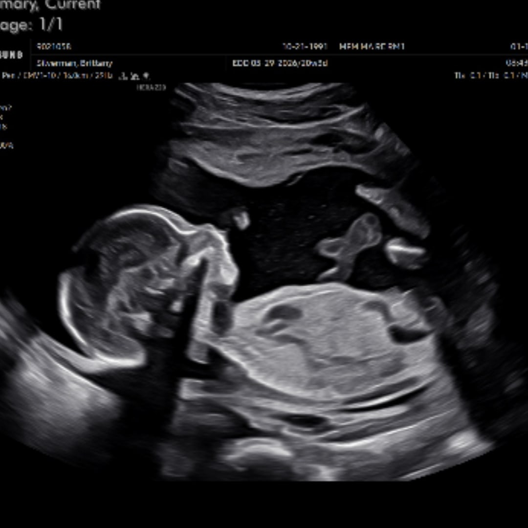 Photo shared by Brittany for their Babylist baby registry.