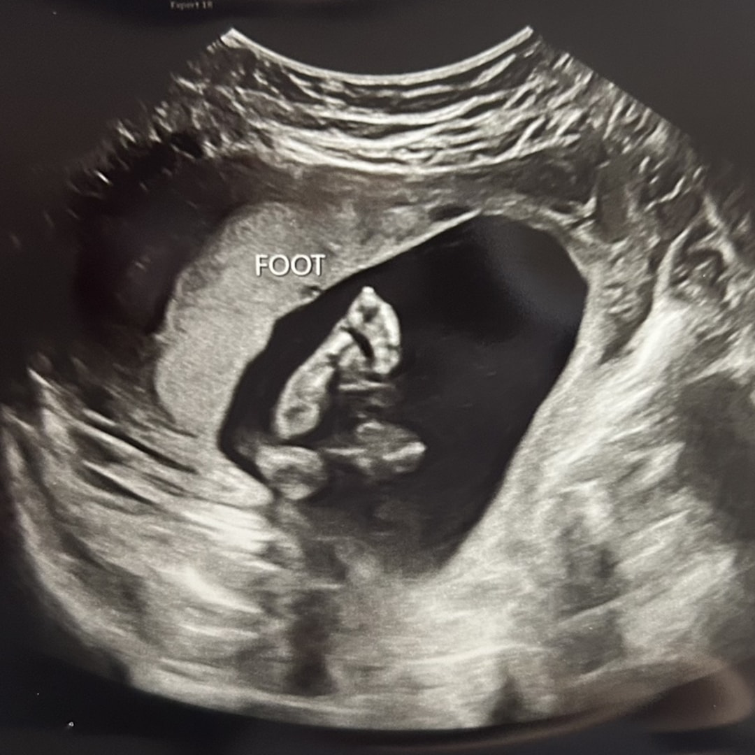 Photo shared by Ashleigh for their Babylist baby registry.