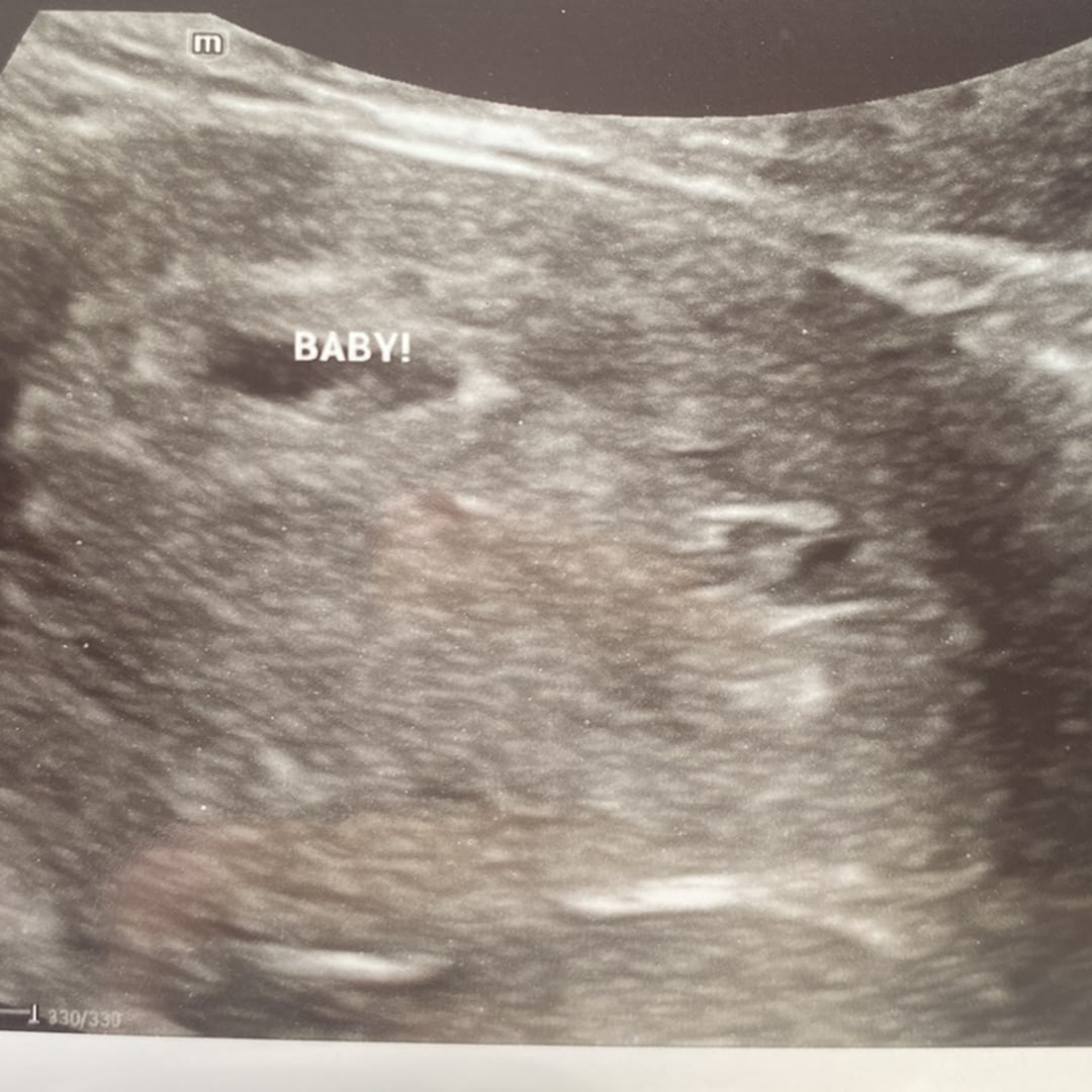 Photo shared by Alejandra for their Babylist baby registry.