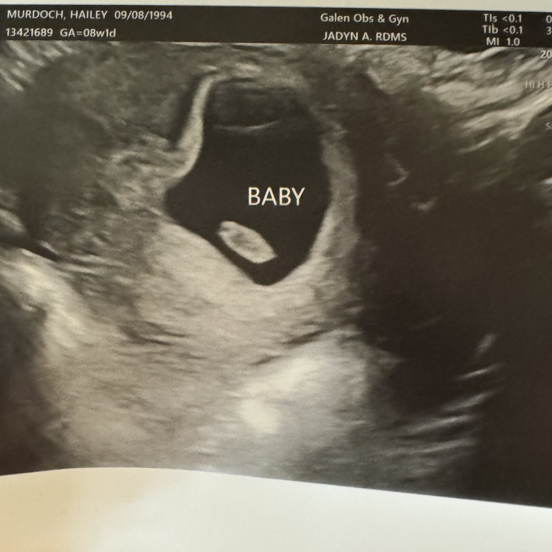 Photo shared by Hailey for their Babylist baby registry.