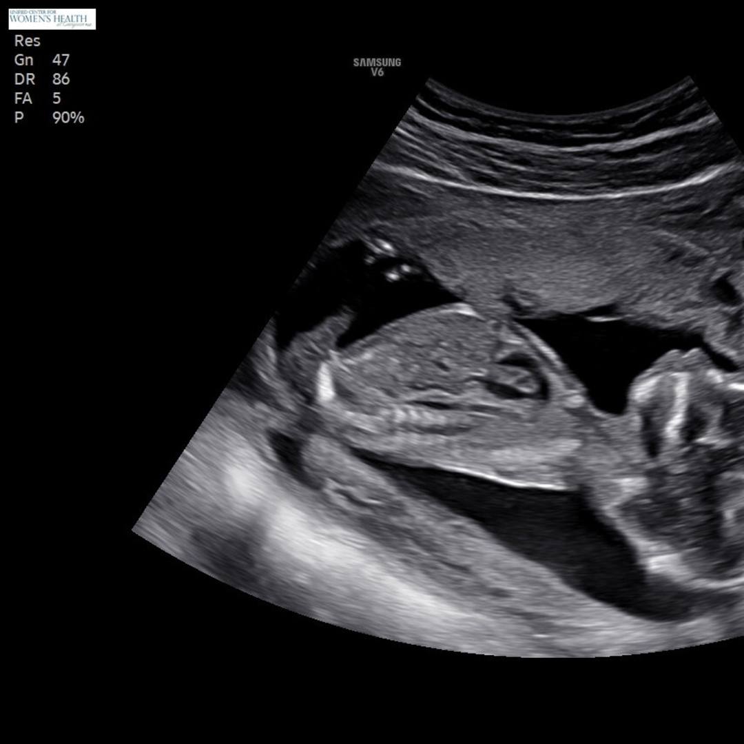 Photo shared by Mikayla for their Babylist baby registry.