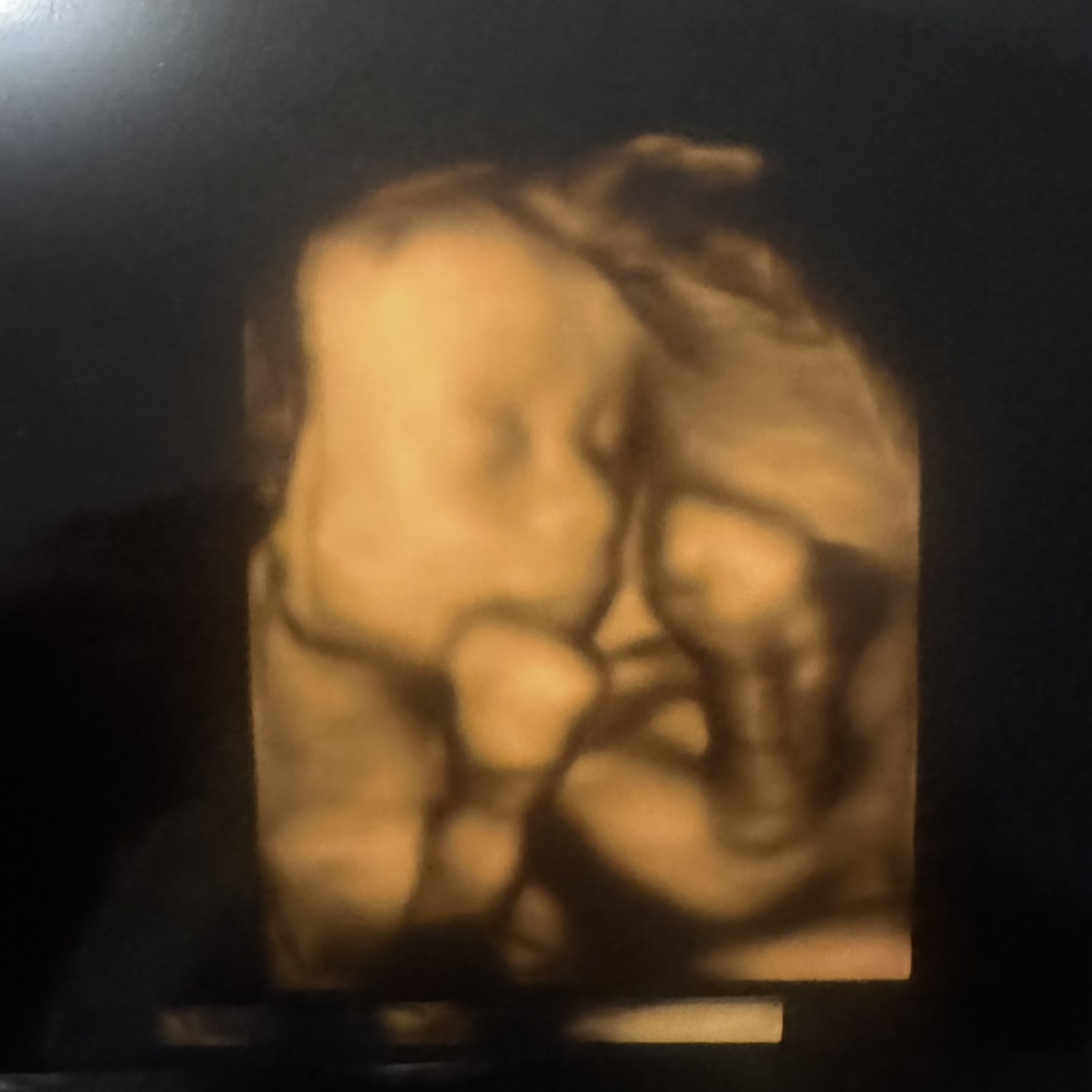 Photo shared by Natalia for their Babylist baby registry.