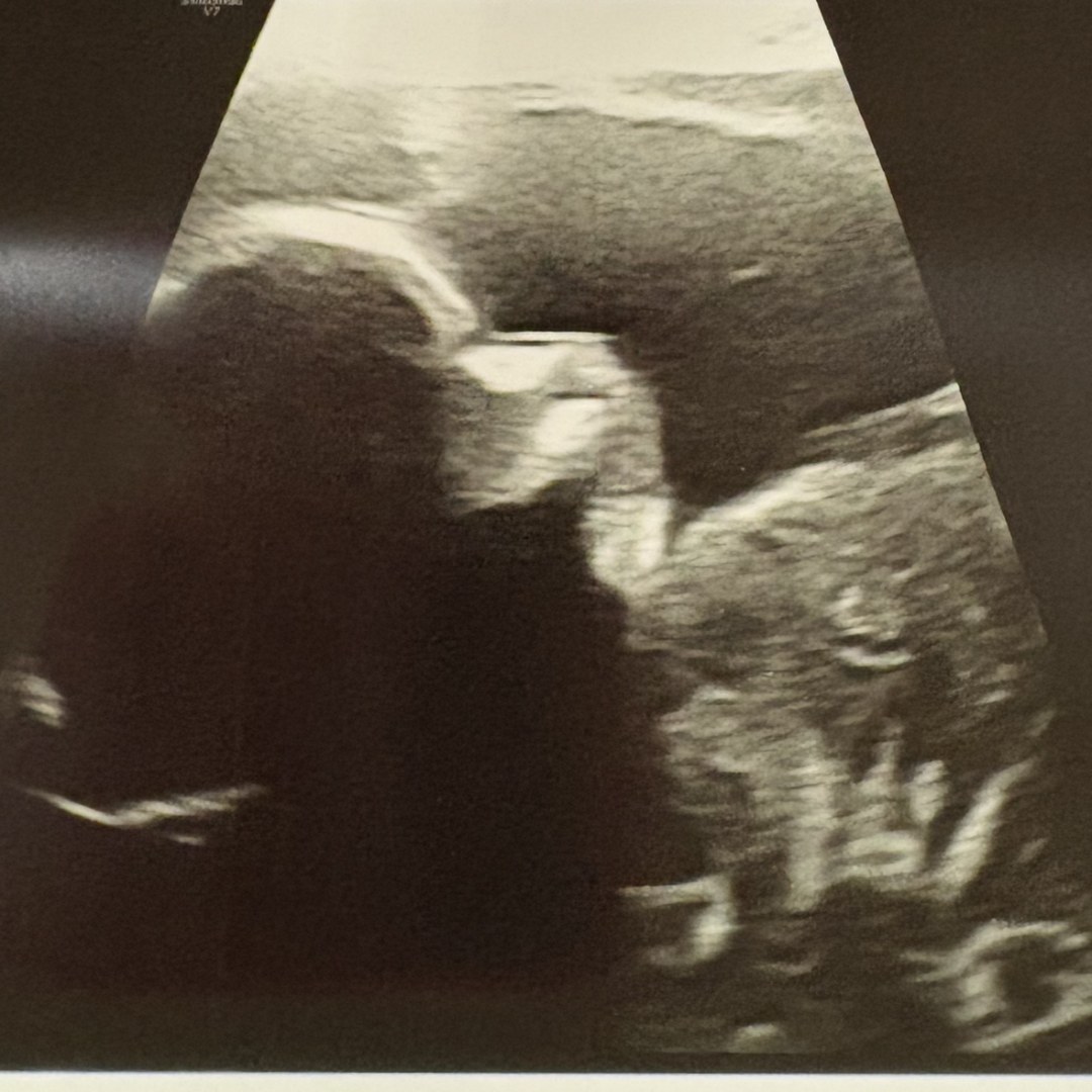 Photo shared by Brittany for their Babylist baby registry.