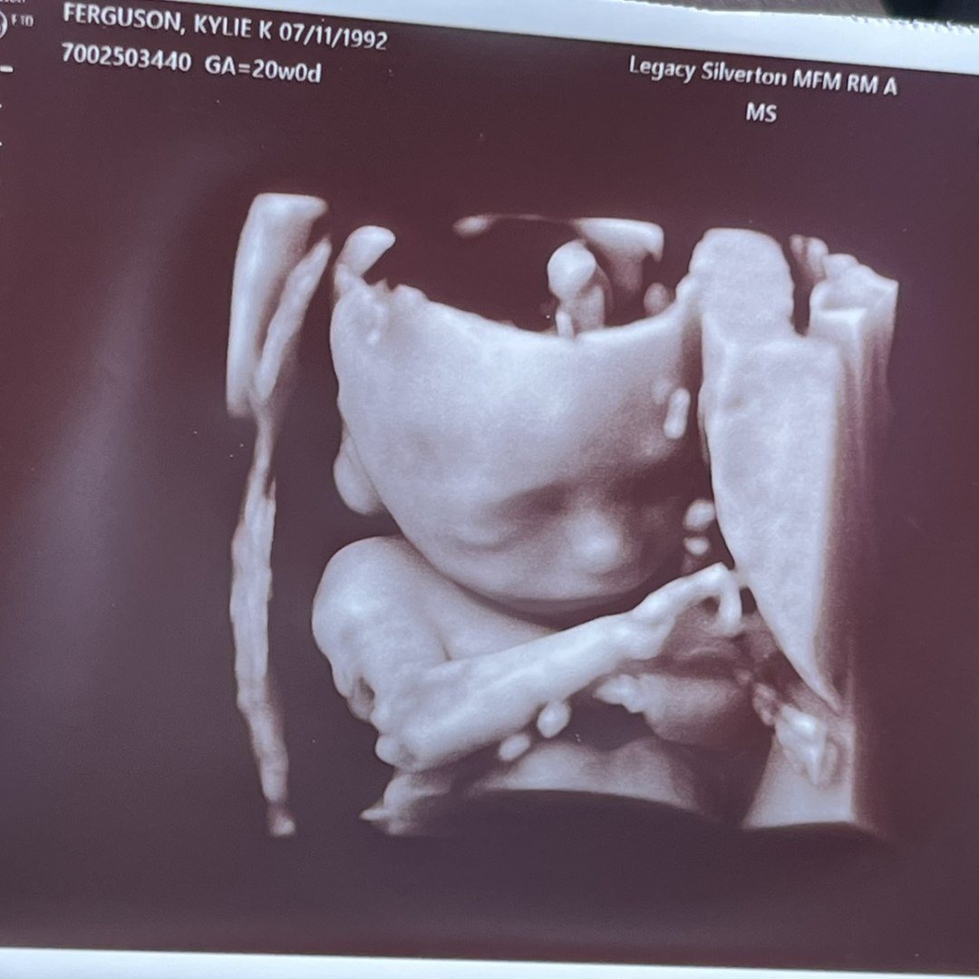 Photo shared by Kylie for their Babylist baby registry.