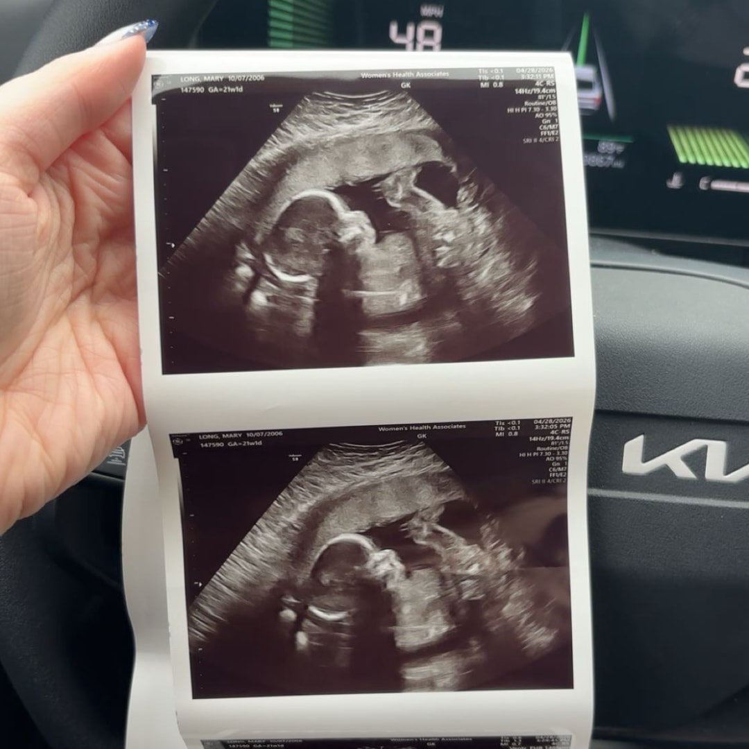 Photo shared by Mary for their Babylist baby registry.