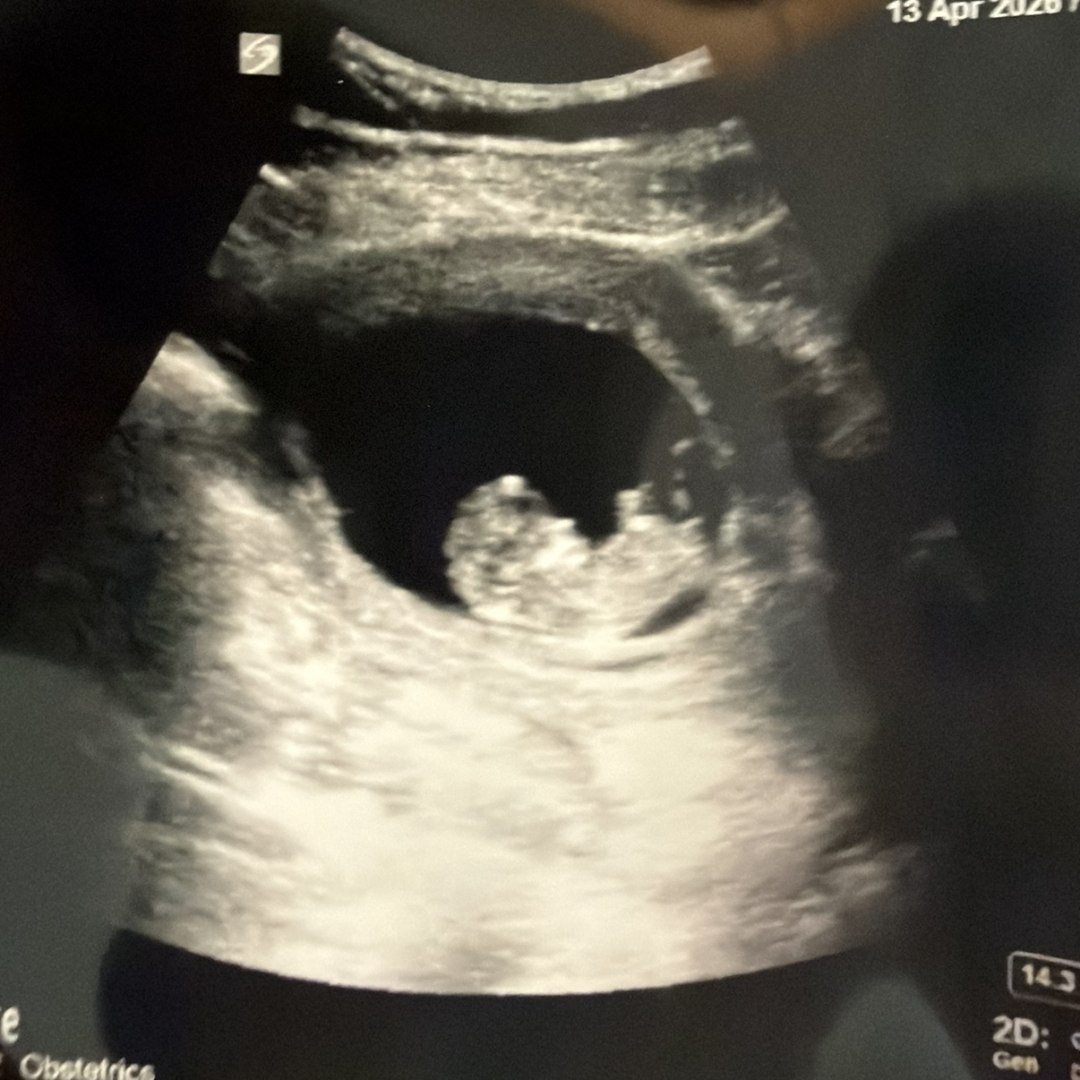 Photo shared by Skyler for their Babylist baby registry.