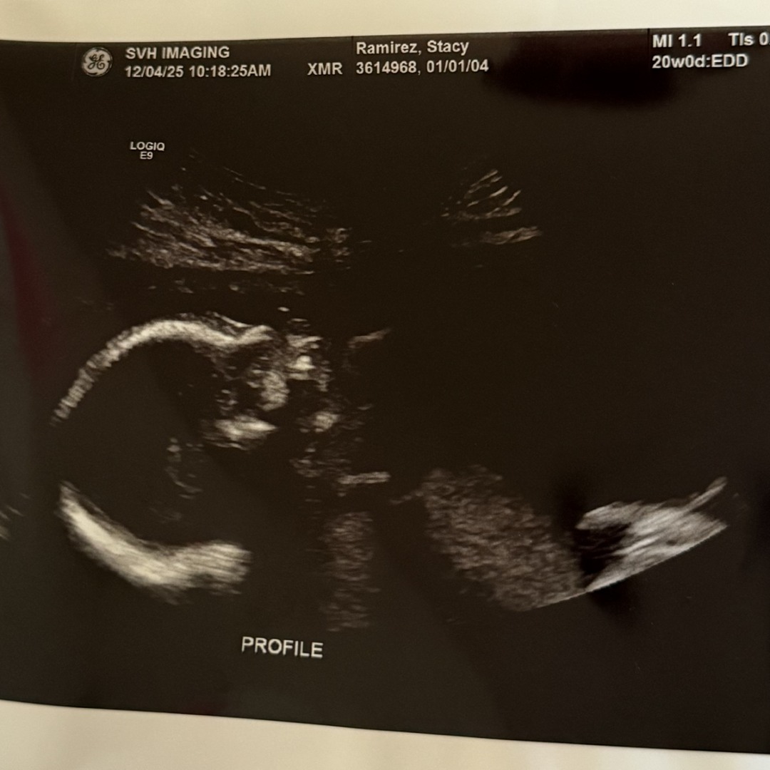 Photo shared by Stacy for their Babylist baby registry.