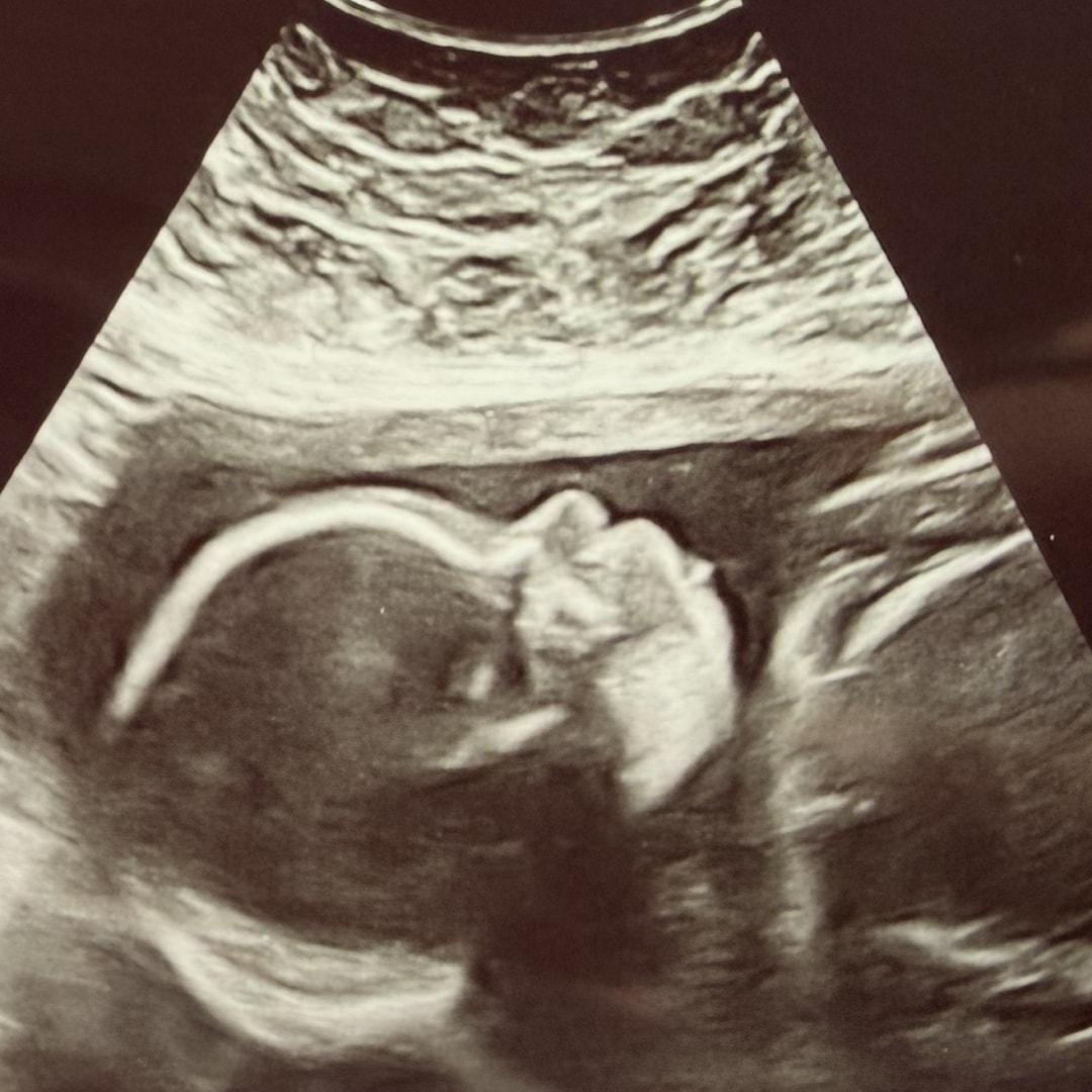 Photo shared by Brandy for their Babylist baby registry.