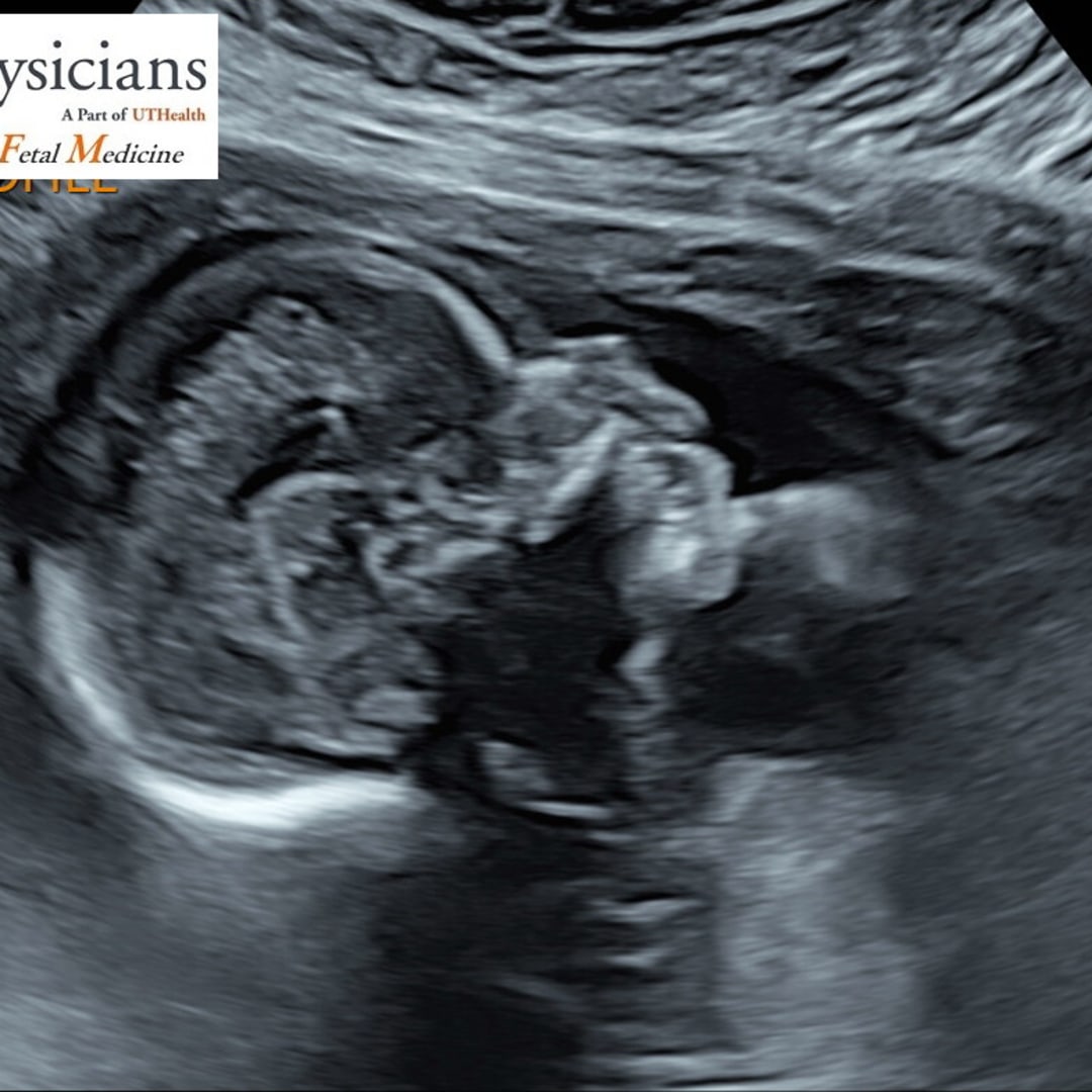 Photo shared by Gabrielle for their Babylist baby registry.