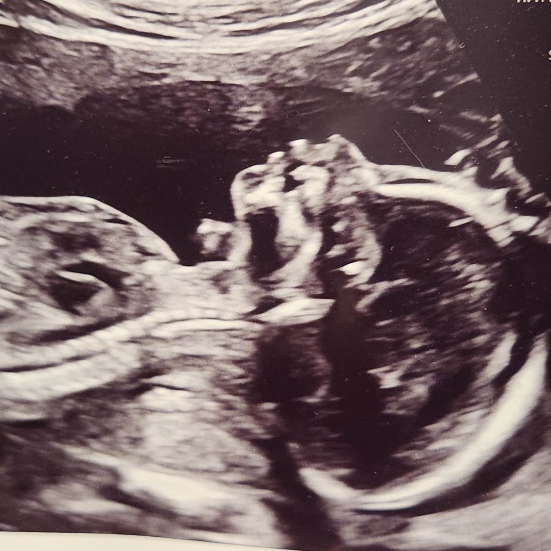 Photo shared by Courtney for their Babylist baby registry.