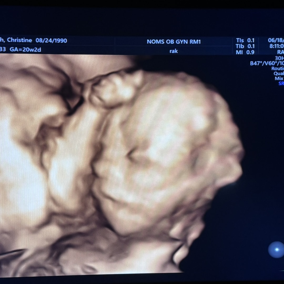 Photo shared by Christine for their Babylist baby registry.