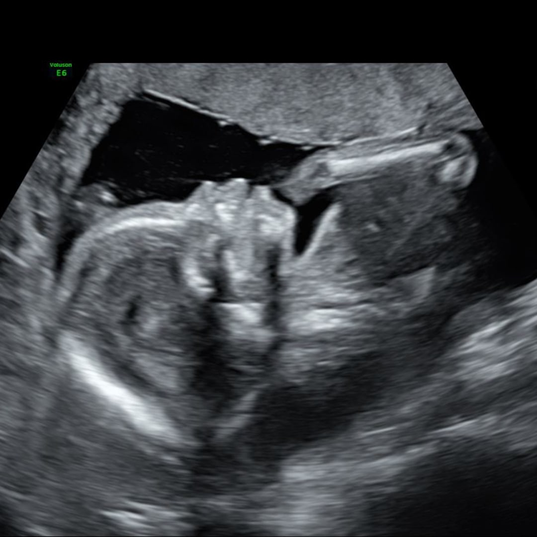 Photo shared by Blue for their Babylist baby registry.