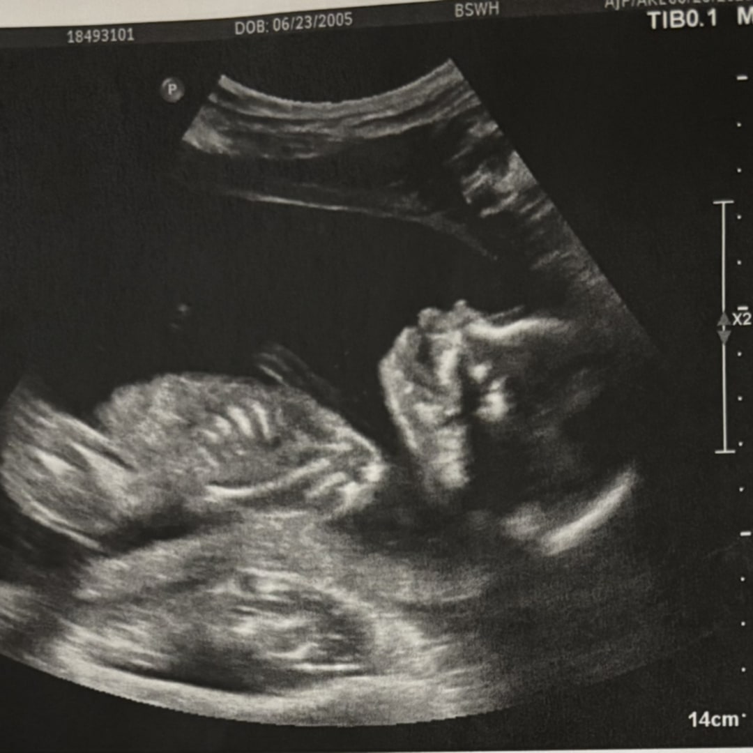 Photo shared by Kyrah for their Babylist baby registry.