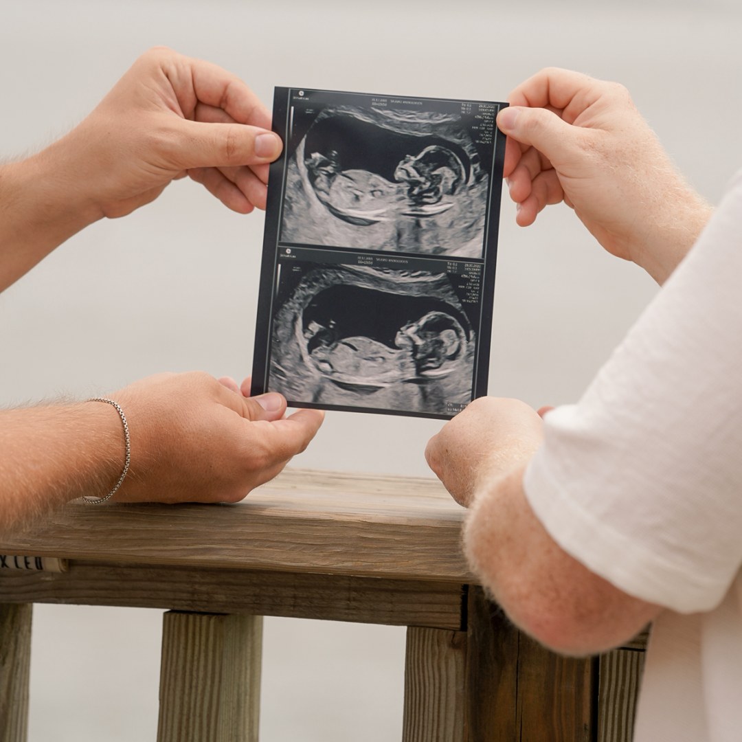 Photo shared by Tyler for their Babylist baby registry.