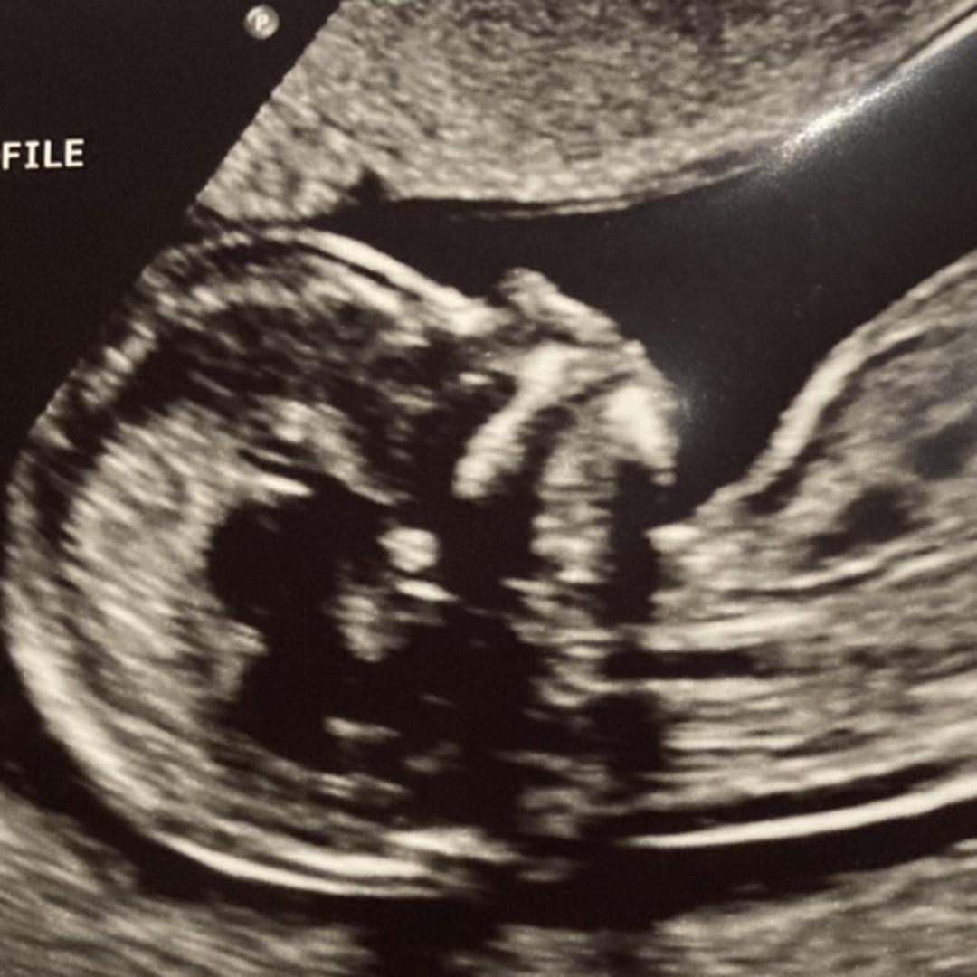 Photo shared by Elizabeth for their Babylist baby registry.