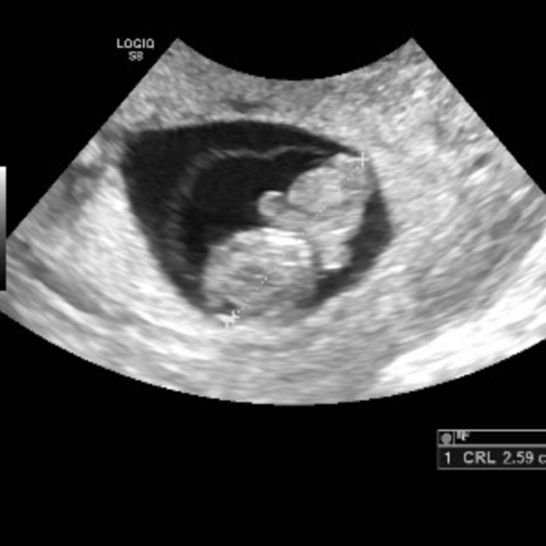 Photo shared by Jeshua for their Babylist baby registry.