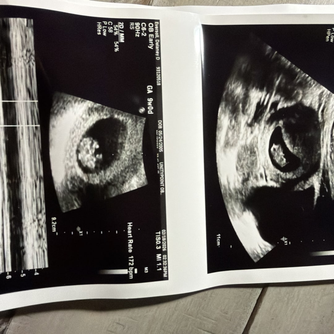 Photo shared by Delaney for their Babylist baby registry.
