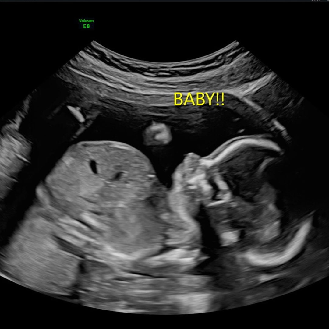 Photo shared by Casey for their Babylist baby registry.