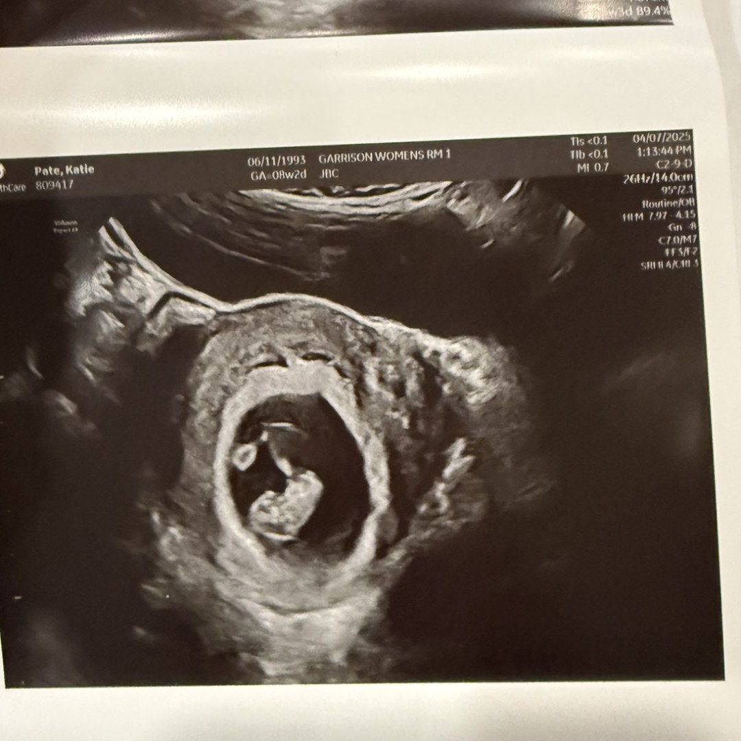 Photo shared by Katie for their Babylist baby registry.