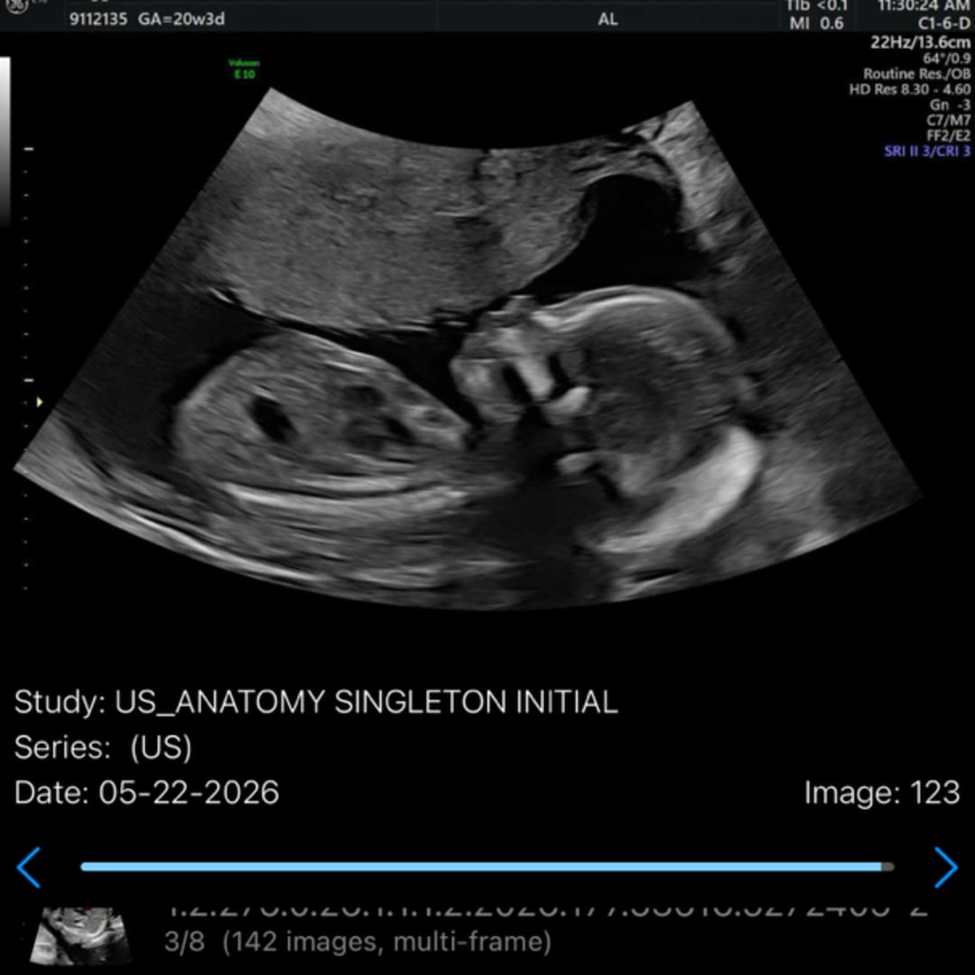 Photo shared by Lilian for their Babylist baby registry.