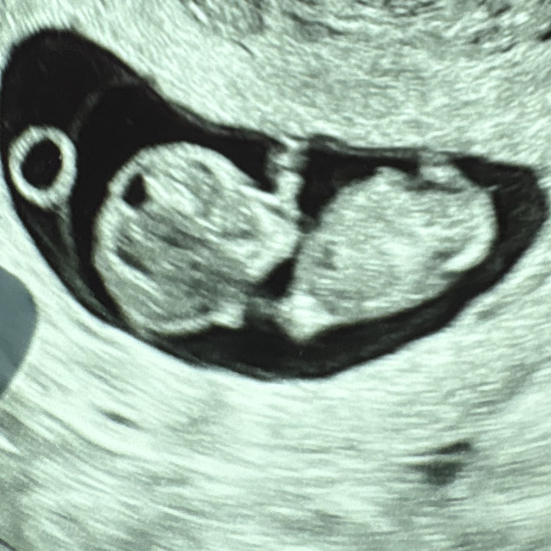 Photo shared by Beatrice for their Babylist baby registry.