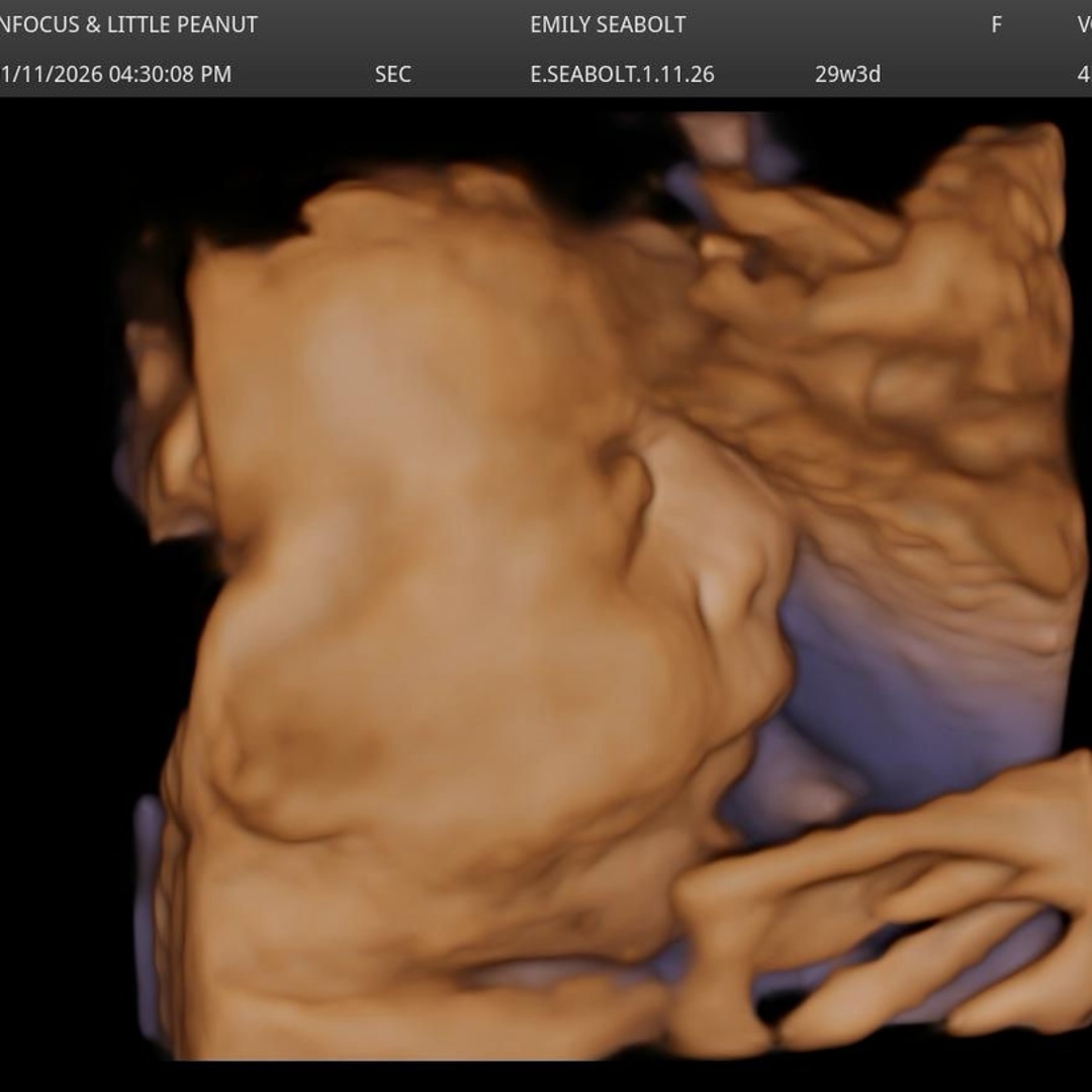 Photo shared by Emily for their Babylist baby registry.