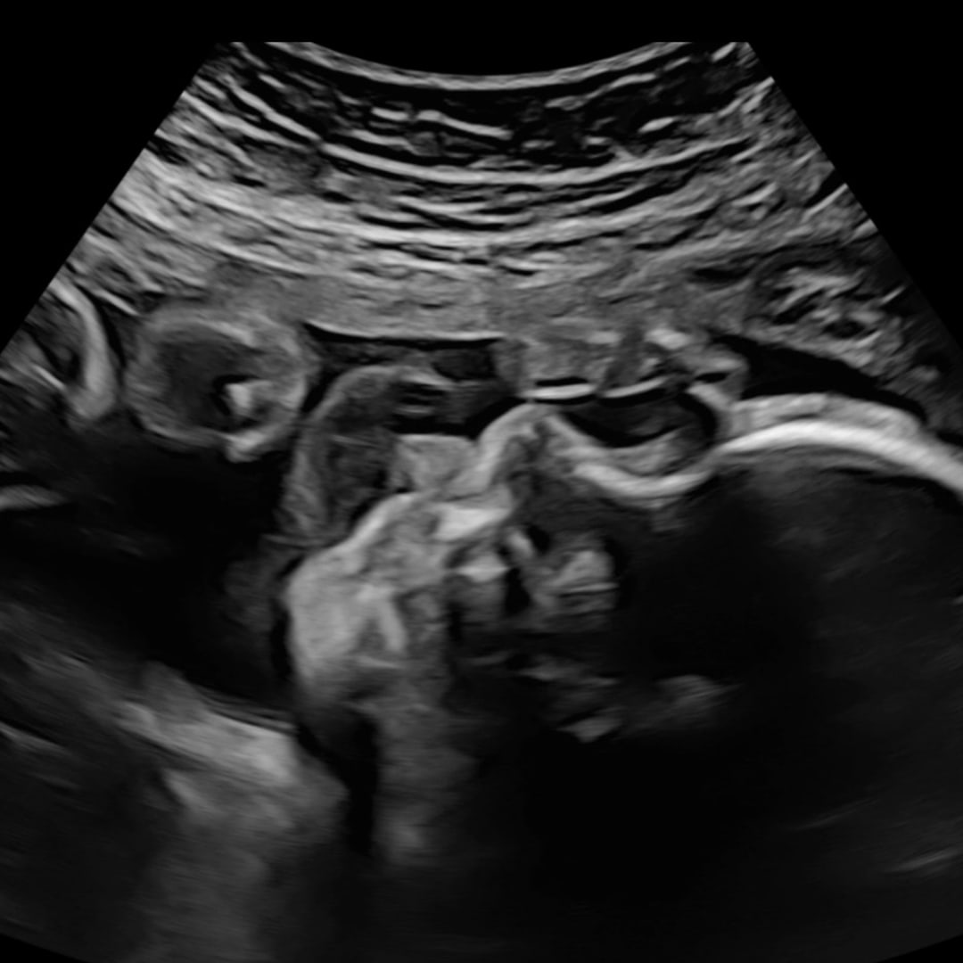 Photo shared by Alexandra for their Babylist baby registry.