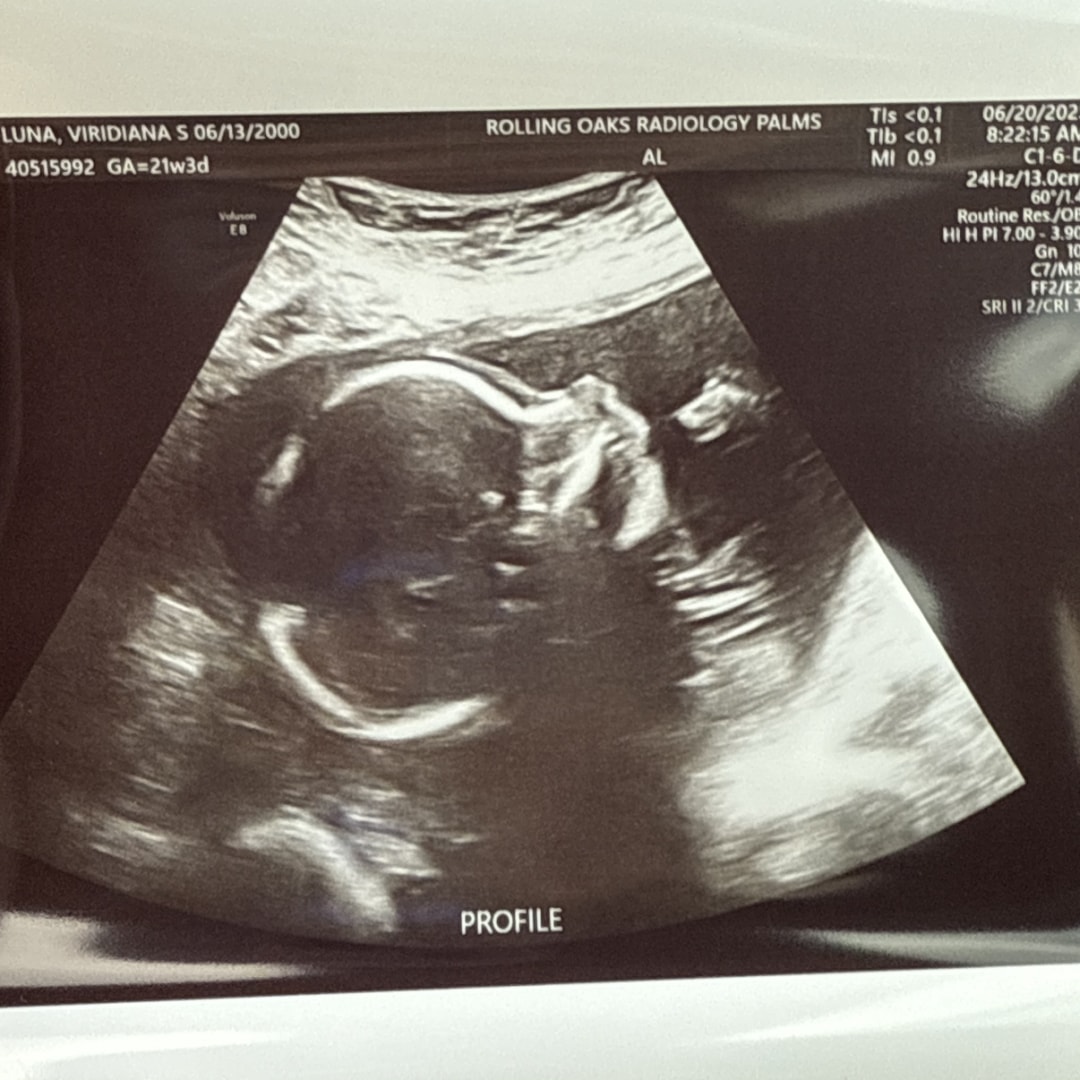 Photo shared by Viridiana for their Babylist baby registry.