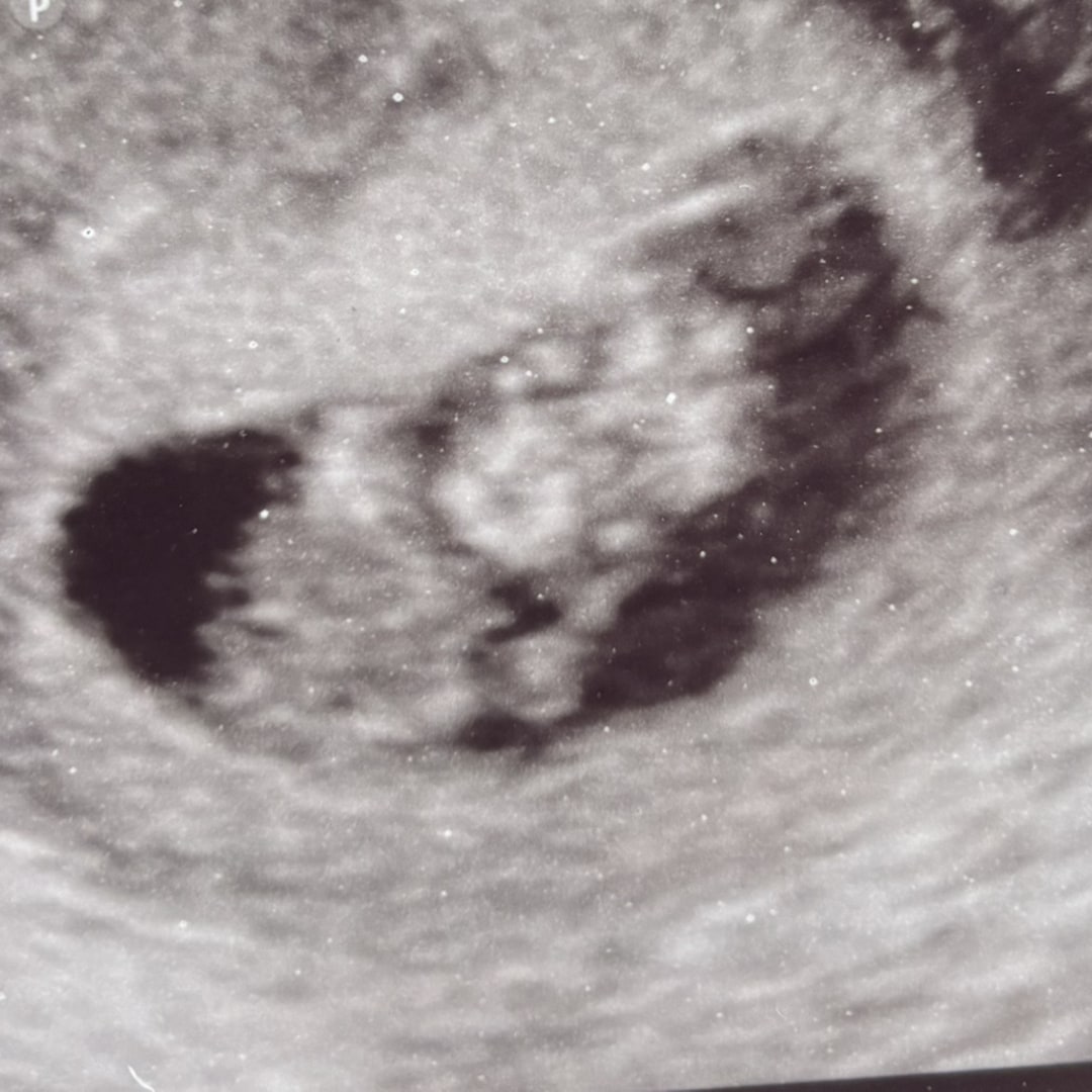 Photo shared by Brittany for their Babylist baby registry.