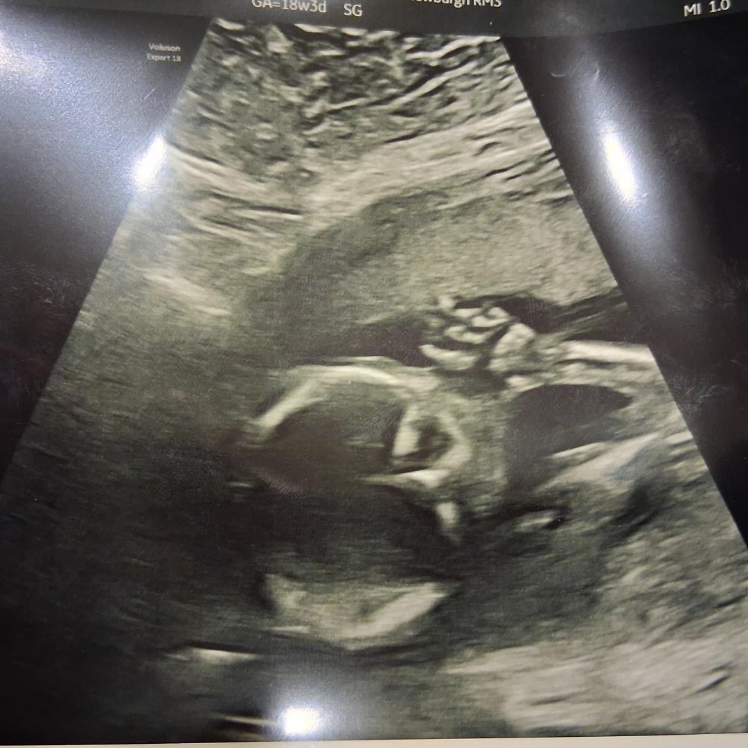 Photo shared by Kenia for their Babylist baby registry.