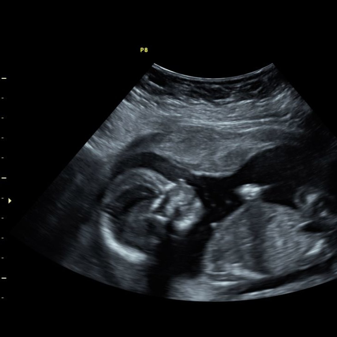 Photo shared by Hailey for their Babylist baby registry.