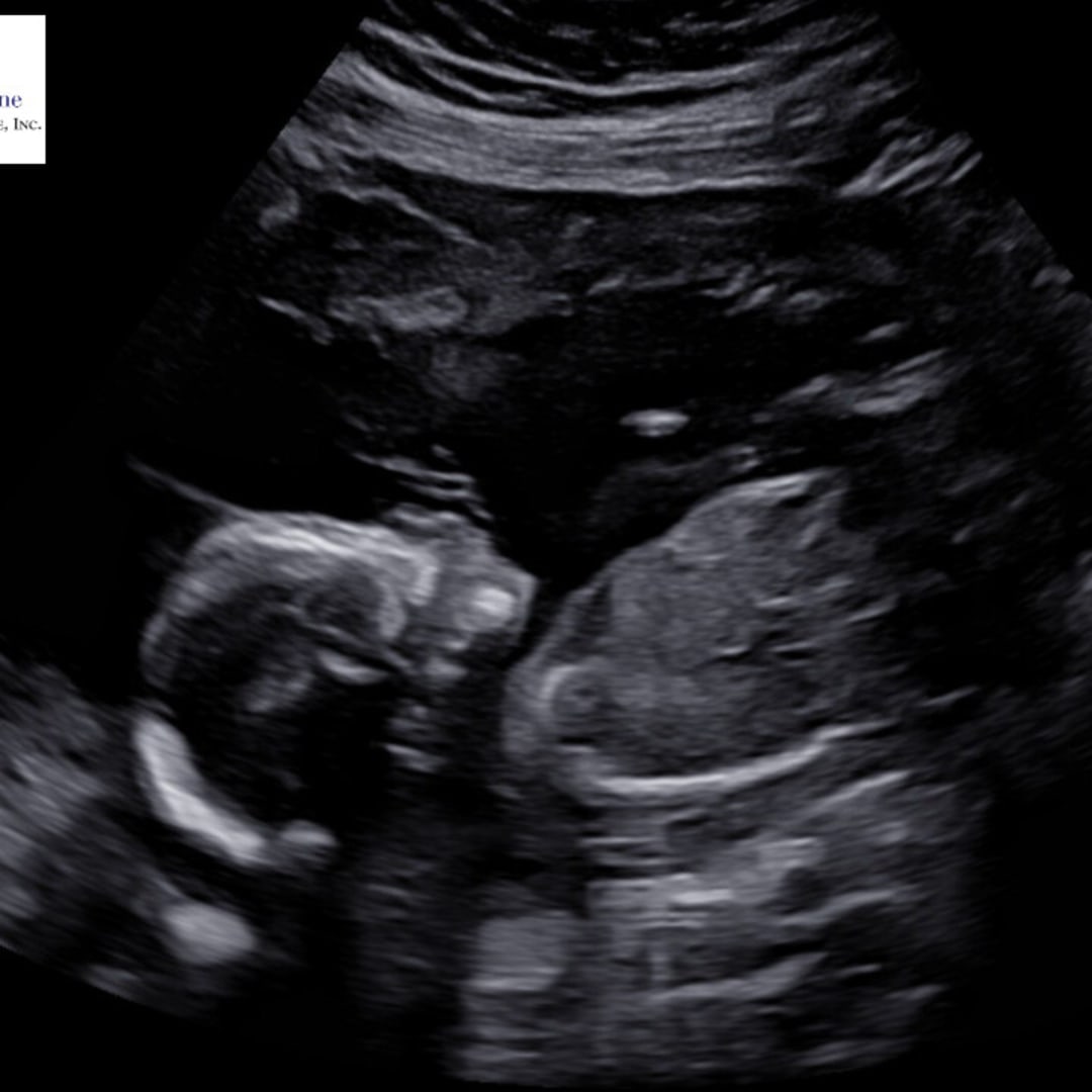 Photo shared by Asia for their Babylist baby registry.