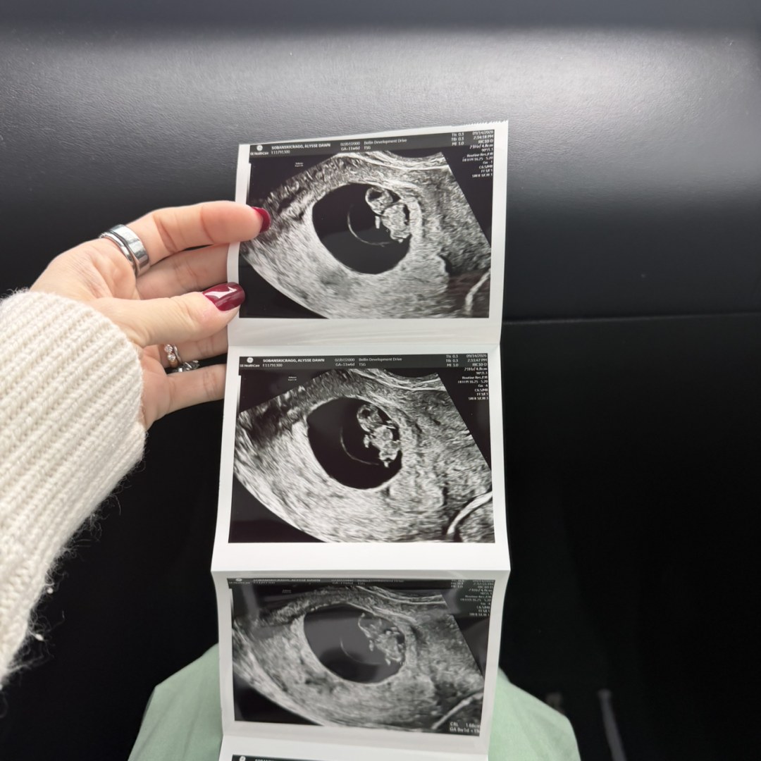 Photo shared by Alysse for their Babylist baby registry.