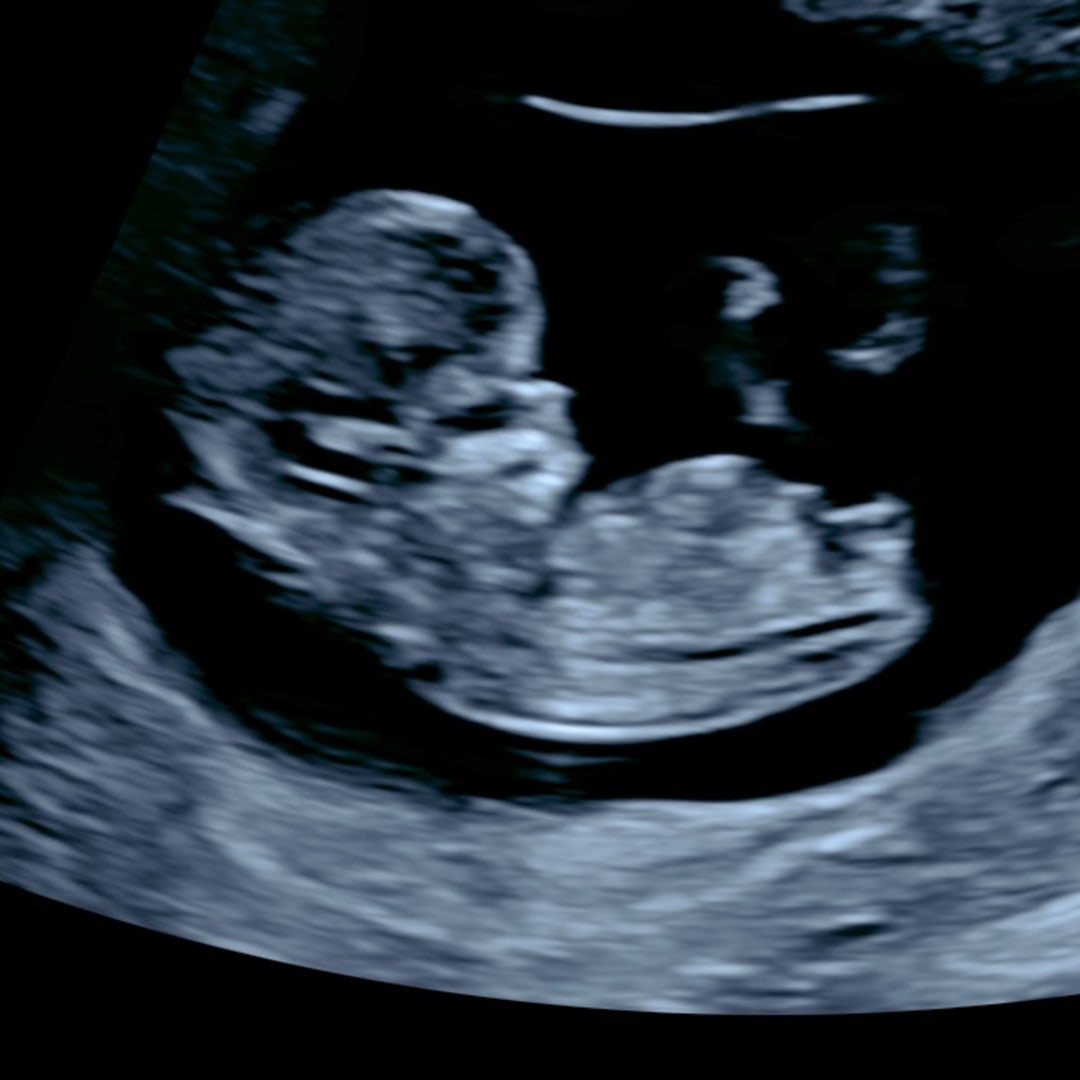 Photo shared by Nick for their Babylist baby registry.