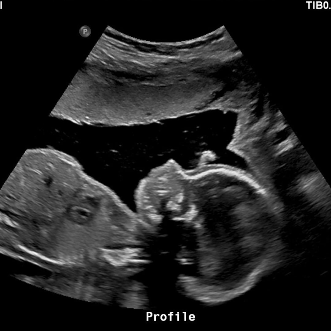 Photo shared by Ashley for their Babylist baby registry.