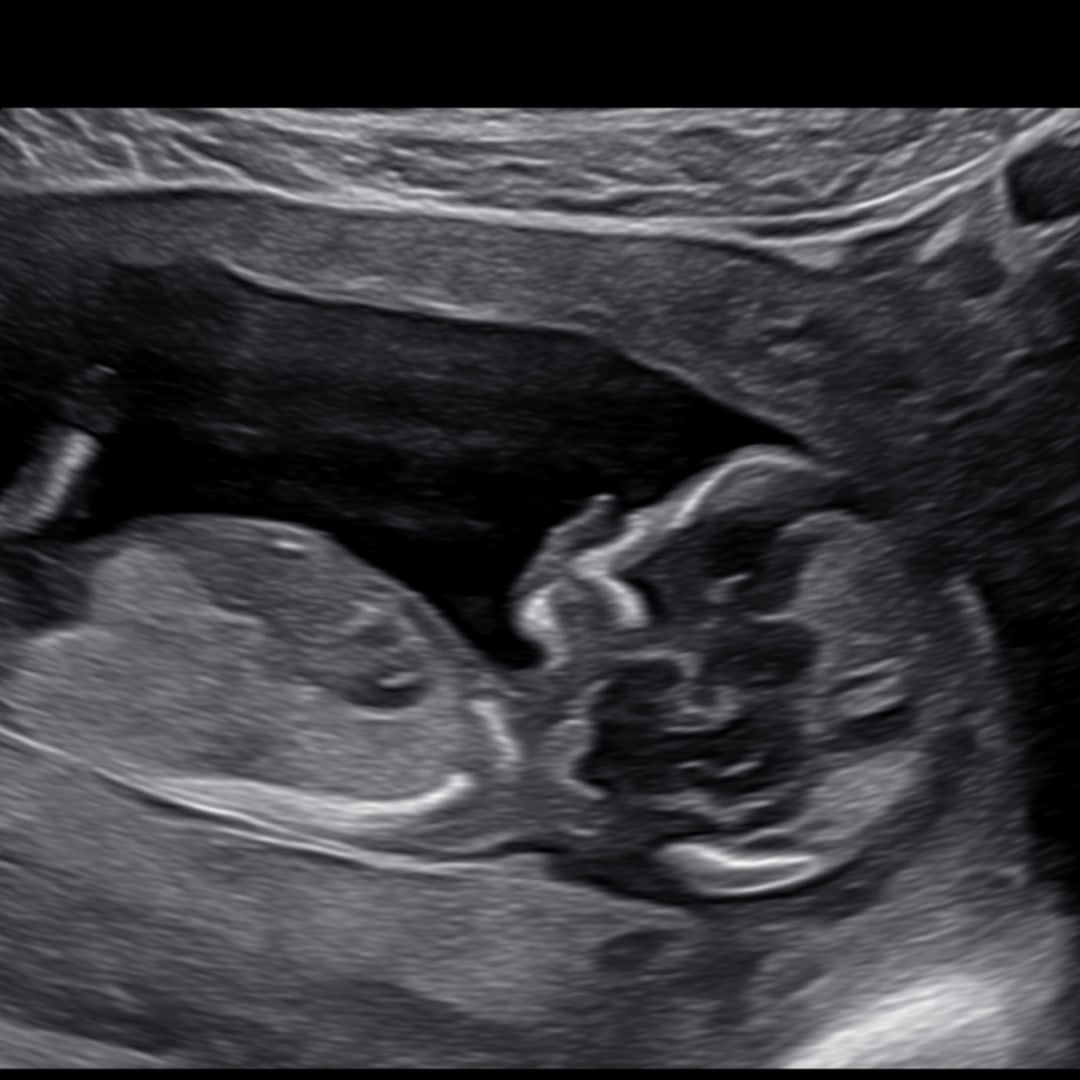 Photo shared by Aly for their Babylist baby registry.