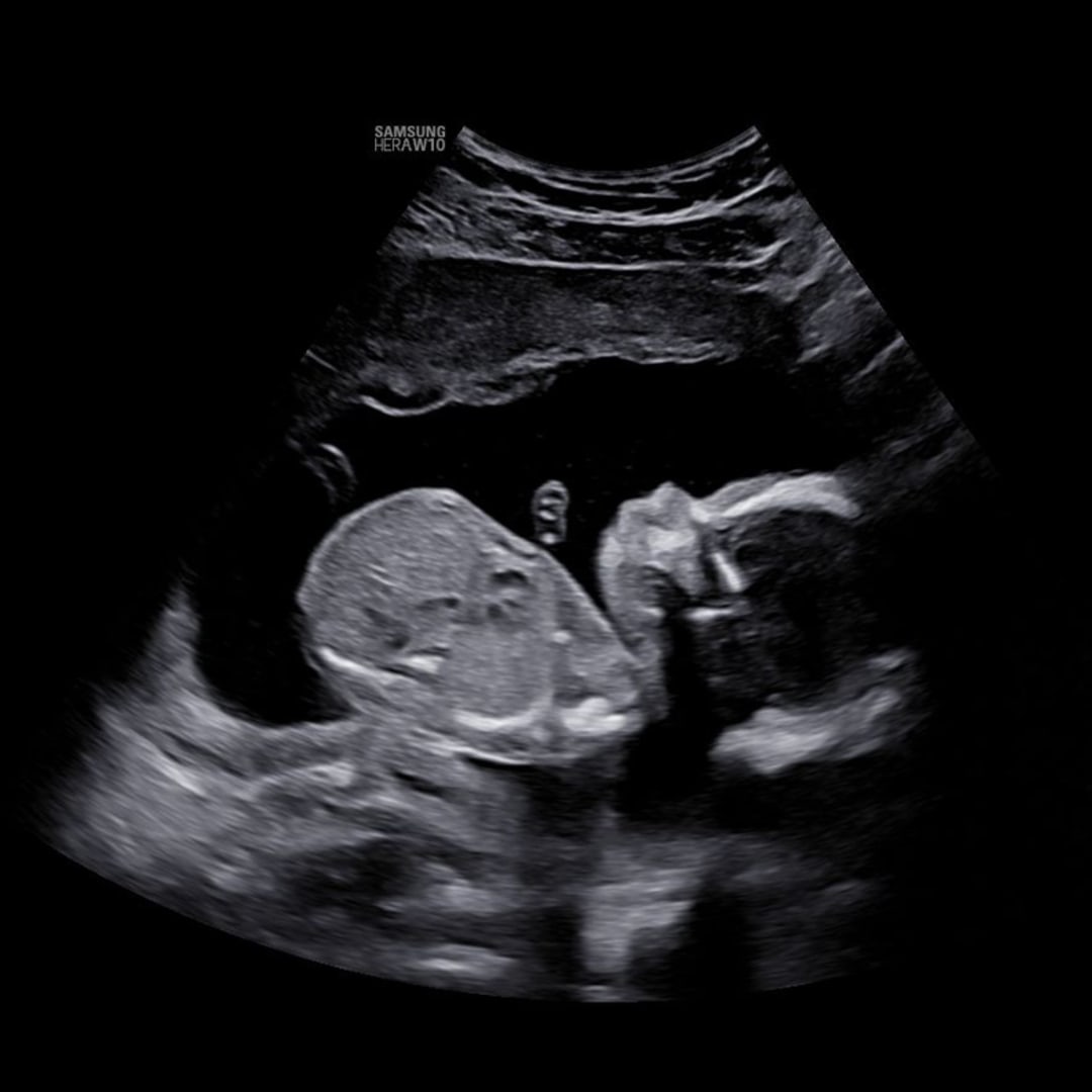Photo shared by Dorian for their Babylist baby registry.