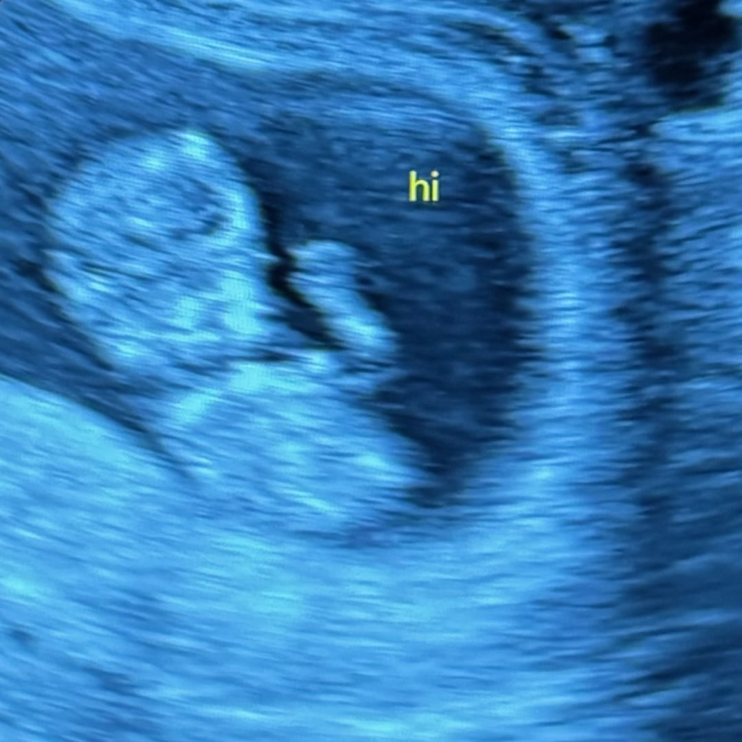 Photo shared by Nackea for their Babylist baby registry.