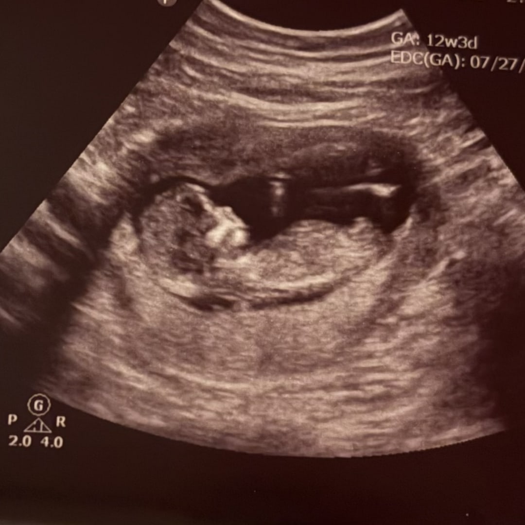 Photo shared by Courtney for their Babylist baby registry.